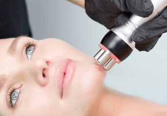 MICRO NEEDLING WITH DERMAPEN